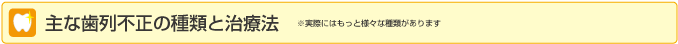 主な歯列不正の種類と治療法